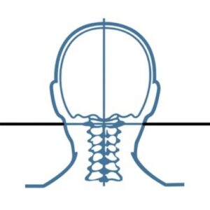 Ocean View Migraine and Chiropractic Center logo